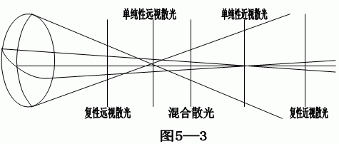 从图5—3可以看出,根据视网膜与散光的两条焦线的